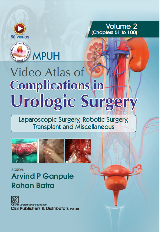 MPUH Video Atlas of Complications in Urological Surgeries Vol 2