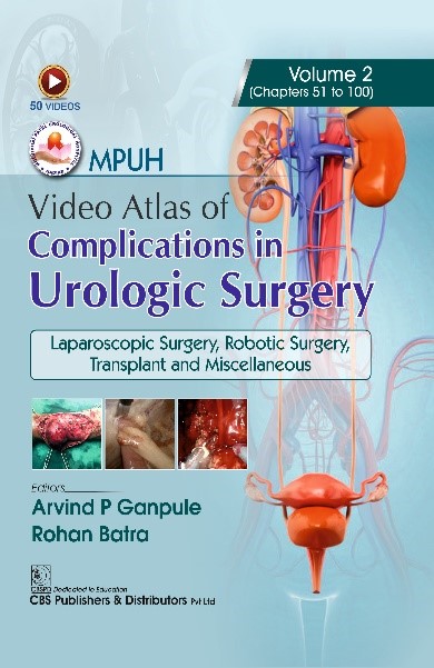 MPUH Video Atlas of Complications in Urological Surgeries Vol 2 for CBS